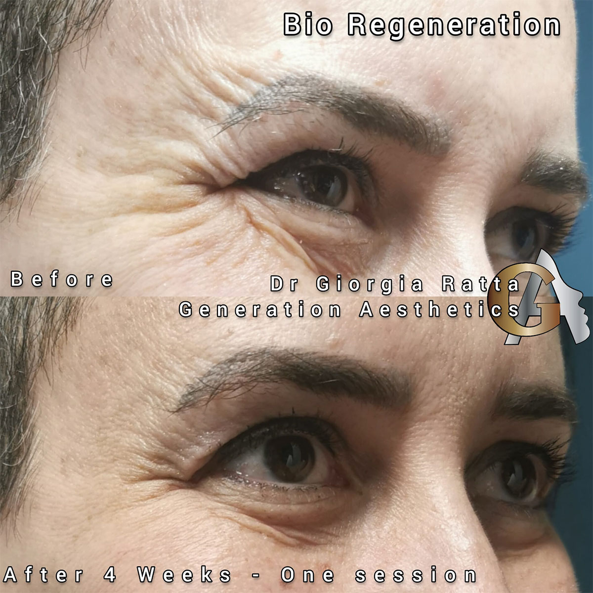 Dr Giorgia Ratta - Generation Aesthetics Clinics - regenerative aesthetic medicine using plenhyage and newsest